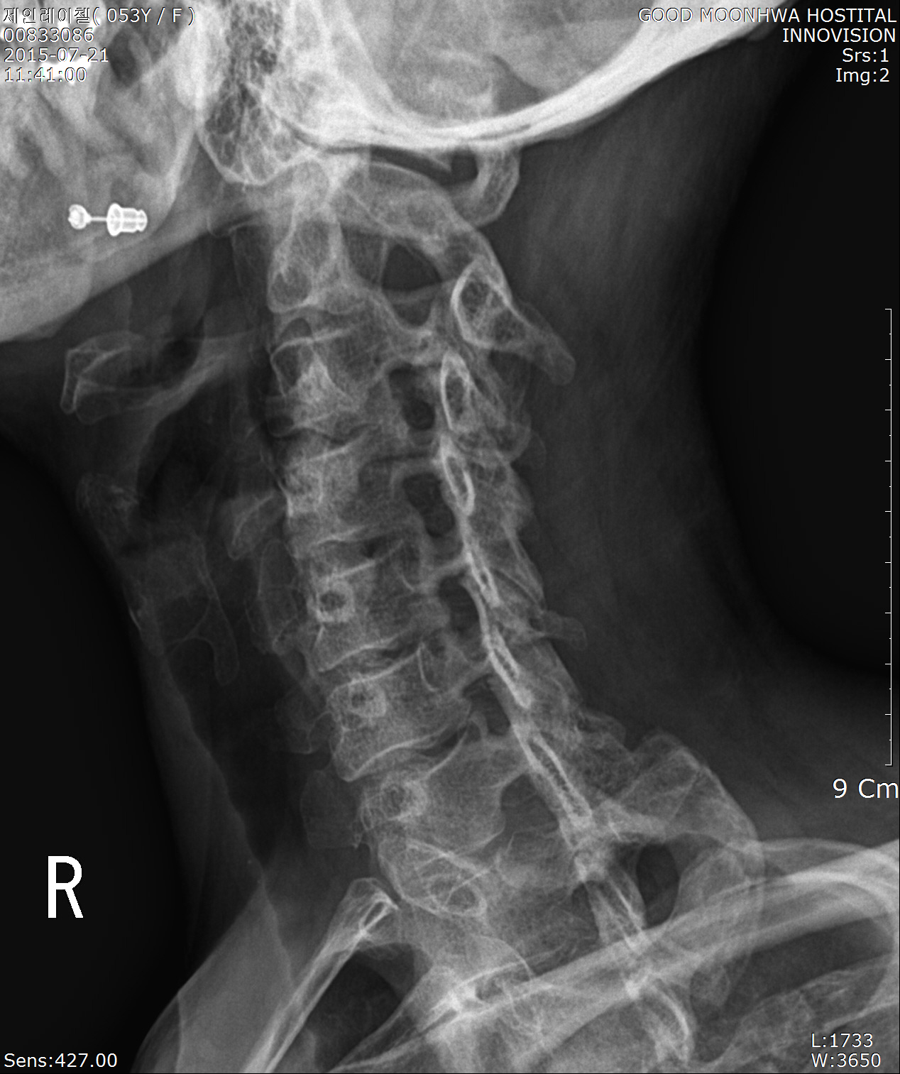 an x-ray of my neck