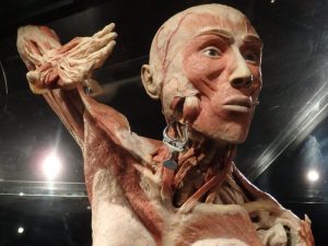 a plastinate