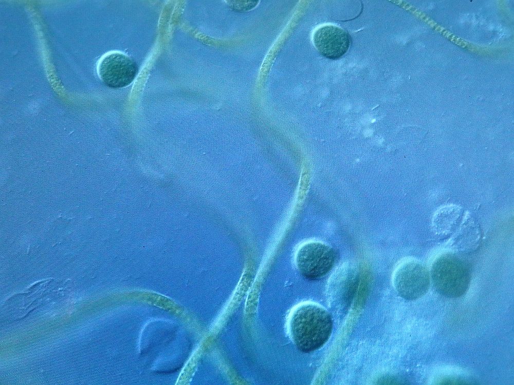 microbes at Micropia: round blue blobs on a blue fleld